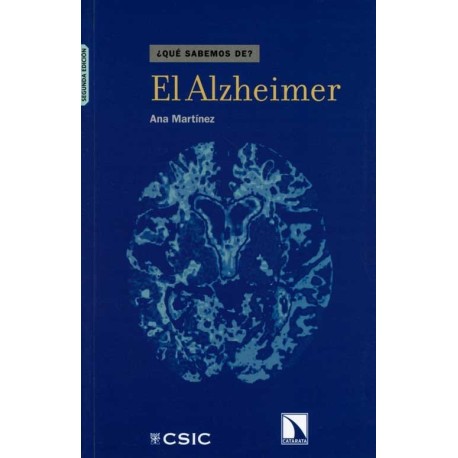 ALZHEIMER, EL