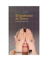 SINDROME DE DOWN, EL