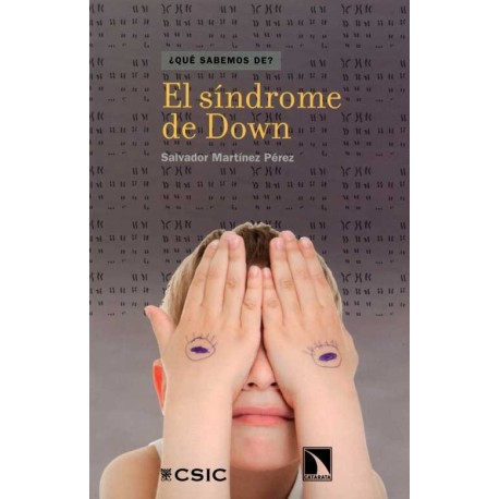 SINDROME DE DOWN, EL